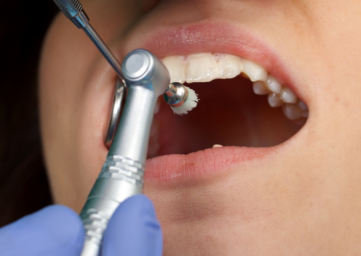 What to Expect from Deep Dental Cleaning