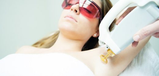 Some FAQs about Laser Hair Removal Answered