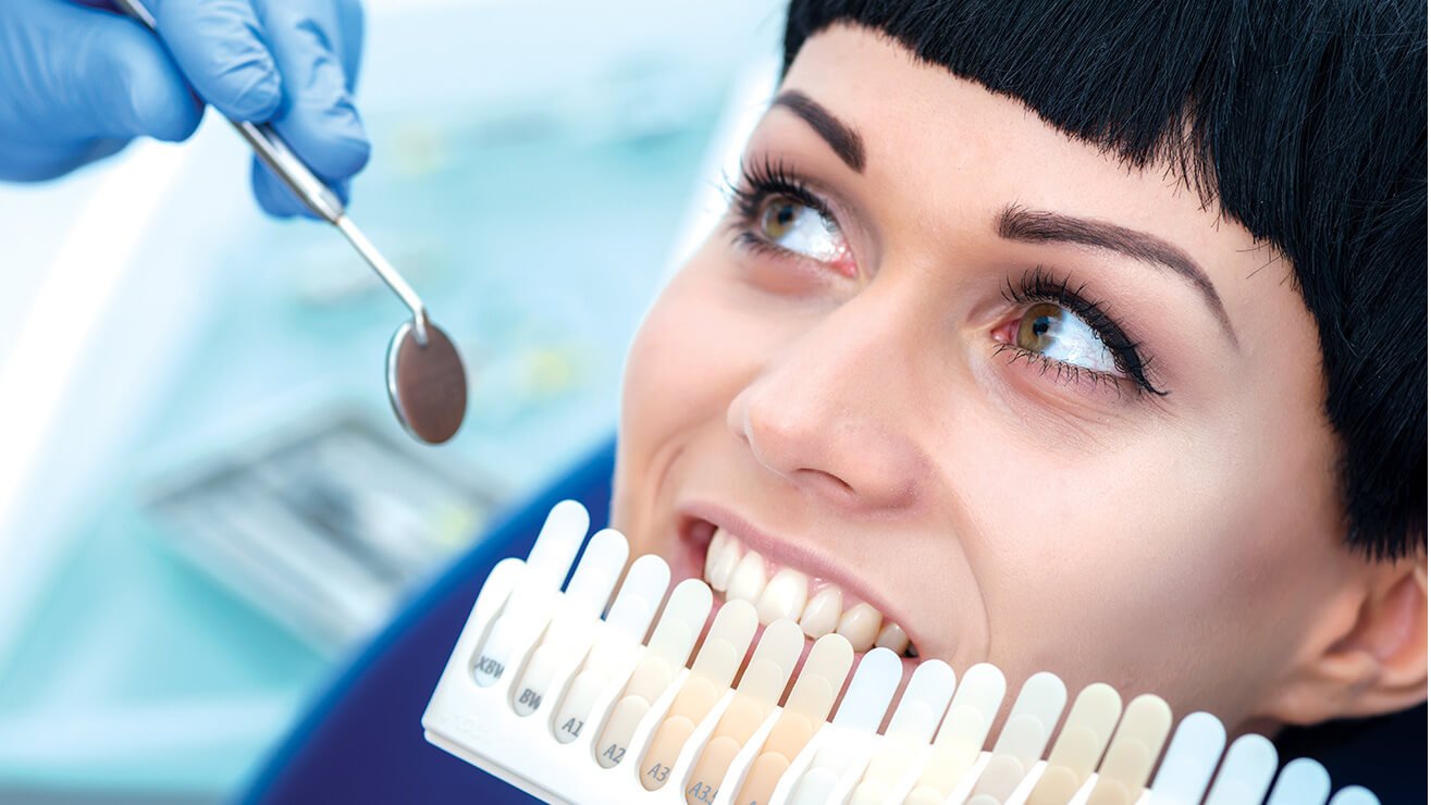 Teeth Whitening Singapore: Is Teeth Whitening Suitable for Everyone?