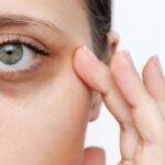 Ultimate Guide to Getting Rid of Dark Eye Circles for Good